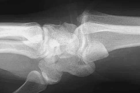 Trauma Board Review 2009: High-Yield MCQs (Set 2) - Figure 25
