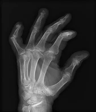Trauma Board Review 2009: High-Yield MCQs (Set 2) - Figure 27