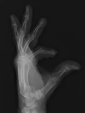 Trauma Board Review 2009: High-Yield MCQs (Set 2) - Figure 28