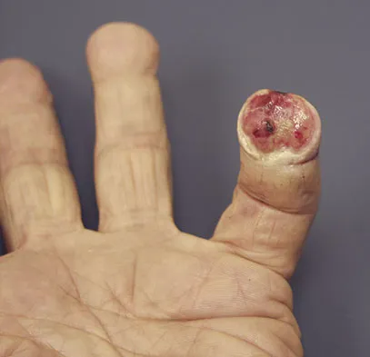 Trauma Board Review 2009: High-Yield MCQs (Set 2) - Figure 29