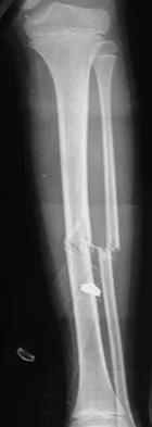 Trauma Board Review 2009: High-Yield MCQs (Set 2) - Figure 3