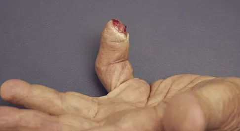 Trauma Board Review 2009: High-Yield MCQs (Set 2) - Figure 31