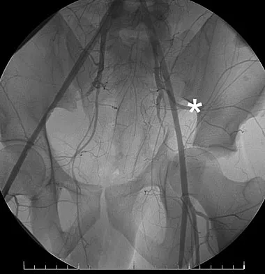 Trauma Board Review 2009: High-Yield MCQs (Set 2) - Figure 32