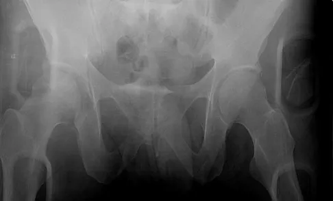 Trauma Board Review 2009: High-Yield MCQs (Set 2) - Figure 34