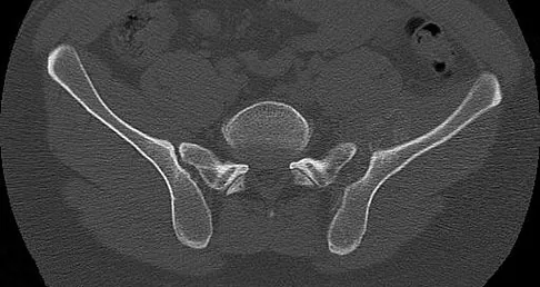 Trauma Board Review 2009: High-Yield MCQs (Set 2) - Figure 7