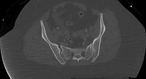 Trauma Board Review 2009: High-Yield MCQs (Set 2) - Figure 9