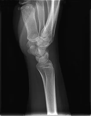 Trauma 2009 Practice Questions: Set 3 (Solved) - Figure 10