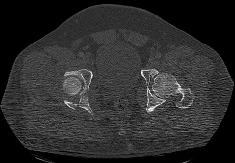 Trauma 2009 Practice Questions: Set 3 (Solved) - Figure 12