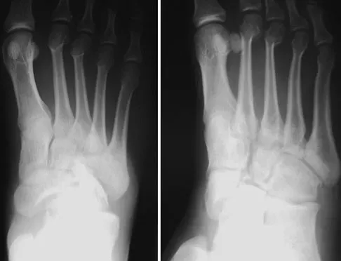 Trauma 2009 Practice Questions: Set 3 (Solved) - Figure 18