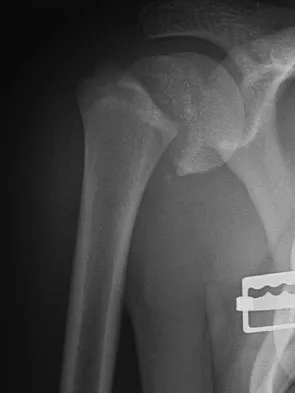 Trauma 2009 Practice Questions: Set 3 (Solved) - Figure 2