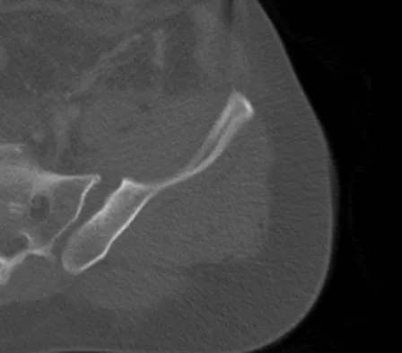 Trauma 2009 Practice Questions: Set 3 (Solved) - Figure 25