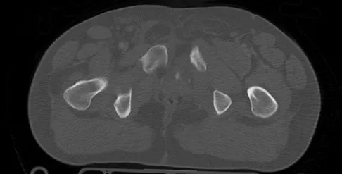 Trauma 2009 Practice Questions: Set 3 (Solved) - Figure 26