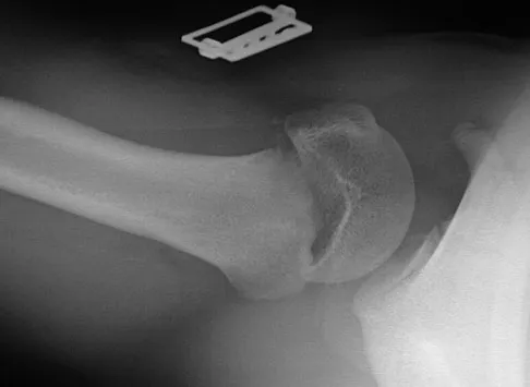 Trauma 2009 Practice Questions: Set 3 (Solved) - Figure 3