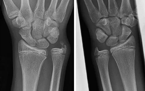 Trauma 2009 Practice Questions: Set 3 (Solved) - Figure 30
