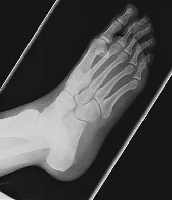 Trauma 2009 Practice Questions: Set 3 (Solved) - Figure 37