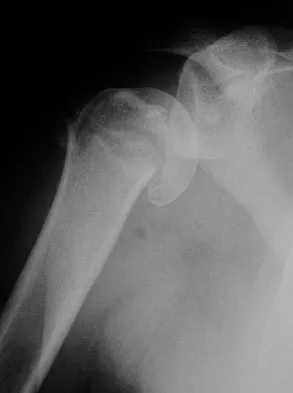 Trauma 2009 Practice Questions: Set 3 (Solved) - Figure 5