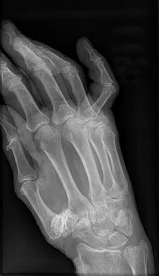 AAOS & ABOS Trauma Board Review (Set 4): Spinal, Pelvic Injuries & Polytrauma MCQs