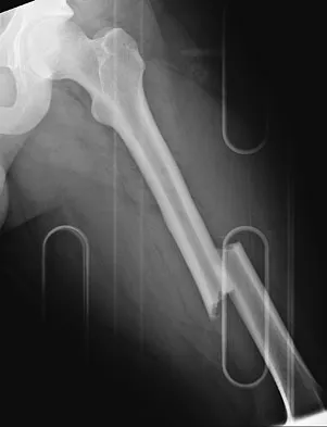 Trauma Board Review 2009: High-Yield MCQs (Set 4) - Figure 10