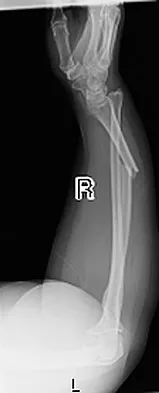 Trauma Board Review 2009: High-Yield MCQs (Set 4) - Figure 12