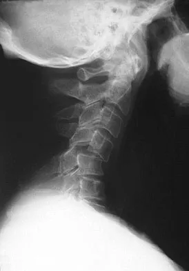 Trauma Board Review 2009: High-Yield MCQs (Set 4) - Figure 16