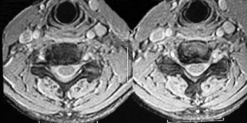Trauma Board Review 2009: High-Yield MCQs (Set 4) - Figure 18