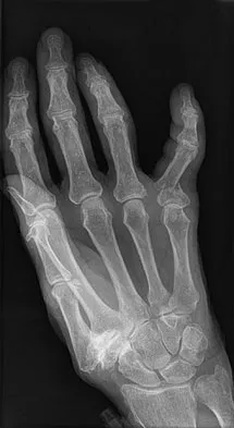 Trauma Board Review 2009: High-Yield MCQs (Set 4) - Figure 2