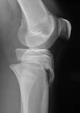 Trauma Board Review 2009: High-Yield MCQs (Set 4) - Figure 21