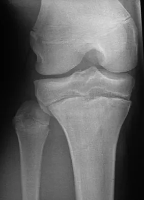 Trauma Board Review 2009: High-Yield MCQs (Set 4) - Figure 22