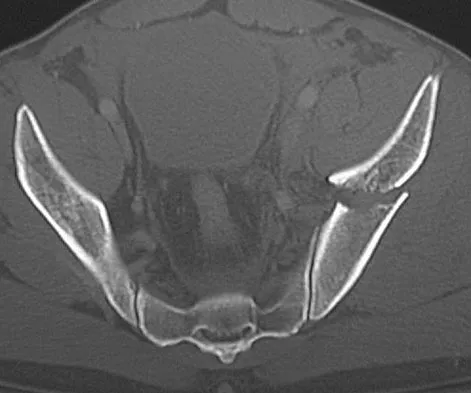 Trauma Board Review 2009: High-Yield MCQs (Set 4) - Figure 31