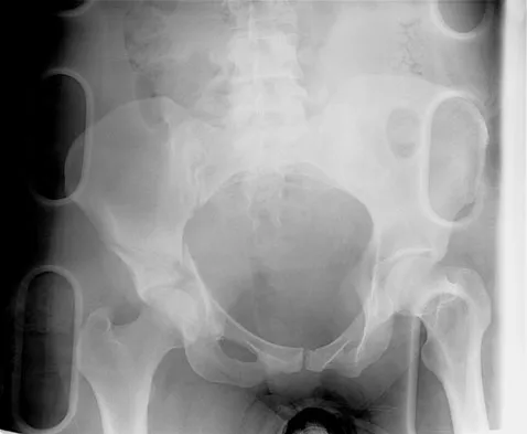 Trauma Board Review 2009: High-Yield MCQs (Set 4) - Figure 6