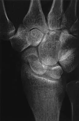 Trauma 2026 MCQs: Board Review Questions & Answers (Part 1) - Figure 103