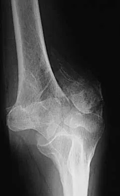 Trauma 2026 MCQs: Board Review Questions & Answers (Part 1) - Figure 105