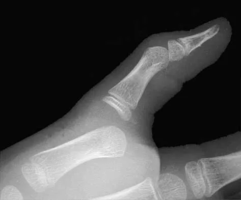 Trauma 2026 MCQs: Board Review Questions & Answers (Part 1) - Figure 119