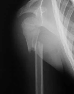 Trauma 2026 MCQs: Board Review Questions & Answers (Part 1) - Figure 121