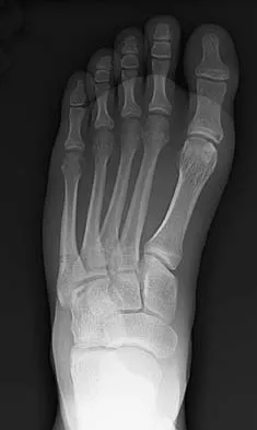 Trauma 2026 MCQs: Board Review Questions & Answers (Part 1) - Figure 127