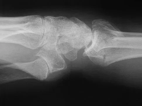 Trauma 2026 MCQs: Board Review Questions & Answers (Part 1) - Figure 137