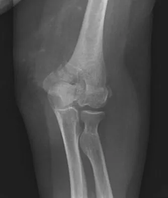 Trauma 2026 MCQs: Board Review Questions & Answers (Part 1) - Figure 143