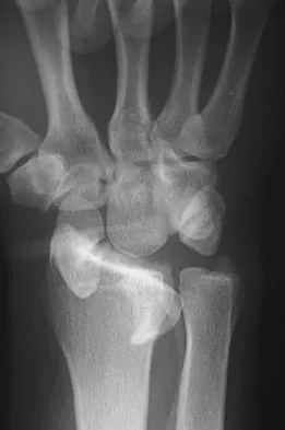 Trauma 2026 MCQs: Board Review Questions & Answers (Part 1) - Figure 147