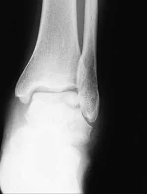 Trauma 2026 MCQs: Board Review Questions & Answers (Part 1) - Figure 17