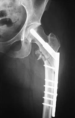 Trauma 2026 MCQs: Board Review Questions & Answers (Part 1) - Figure 65