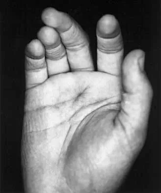 Trauma 2026 MCQs: Board Review Questions & Answers (Part 1) - Figure 79