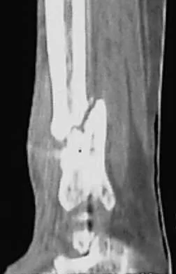 Trauma 2026 MCQs: Board Review Questions & Answers (Part 1) - Figure 93