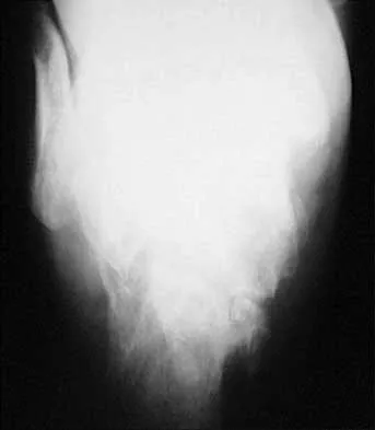 Trauma 2026 MCQs: Board Review Questions & Answers (Part 2) - Figure 103