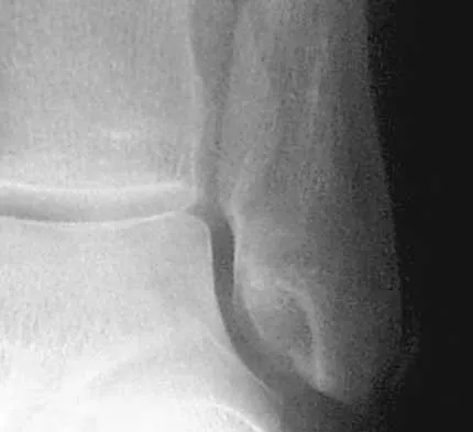 Trauma 2026 MCQs: Board Review Questions & Answers (Part 2) - Figure 127