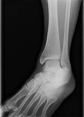 Trauma 2026 MCQs: Board Review Questions & Answers (Part 2) - Figure 145