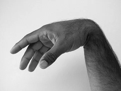 Trauma 2026 MCQs: Board Review Questions & Answers (Part 2) - Figure 155