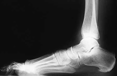 Trauma 2026 MCQs: Board Review Questions & Answers (Part 2) - Figure 27