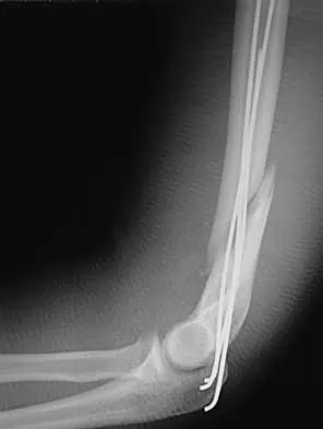 Trauma 2026 MCQs: Board Review Questions & Answers (Part 2) - Figure 31