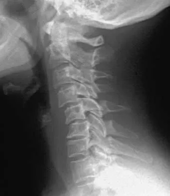 Trauma 2026 MCQs: Board Review Questions & Answers (Part 2) - Figure 43