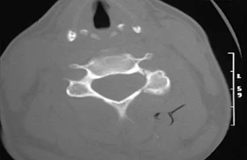 Trauma 2026 MCQs: Board Review Questions & Answers (Part 2) - Figure 47
